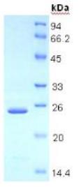 SDS-PAGE (THBS1-2657H).jpg